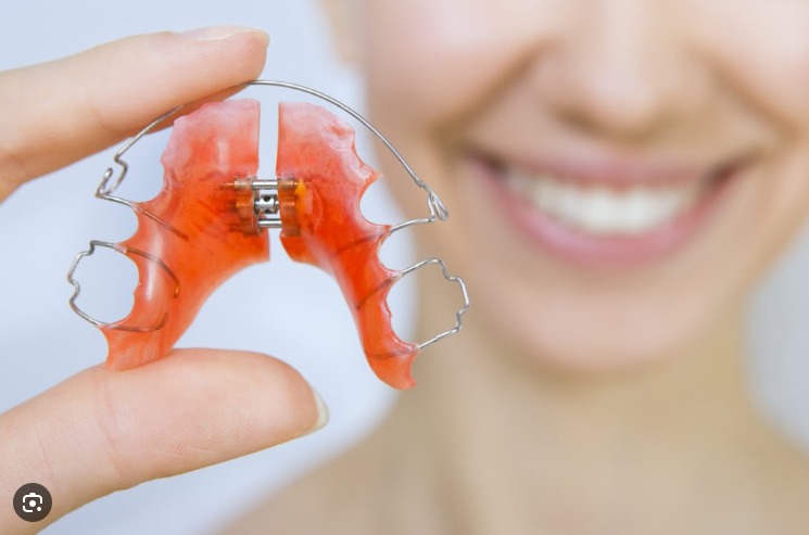 imagen muestra trabajo de una clínica dental en Bogotá