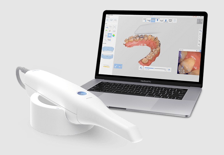 imagen muestra escáner intraoral en Bogotá