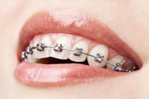 imagen describe las mejores clínicas de ortodoncia