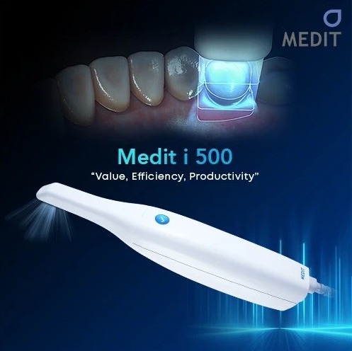 imagen muestra servicio de escáner intraoral