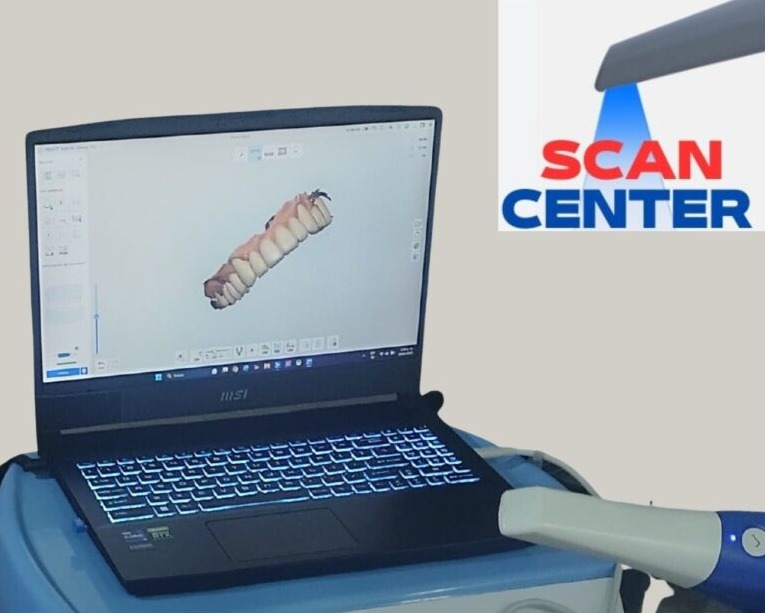 imagen muestra el servicio de escáner odontológico