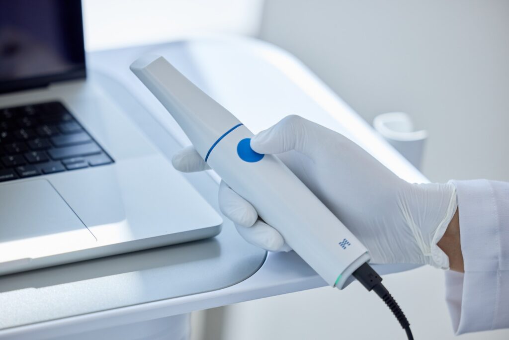 imagen muestra el servicio de scanner dental